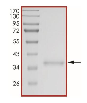 The purity of 2019-nCoV Spike protein S1 subunit, RBD (E484Q) was determined to be >90% by densitometry